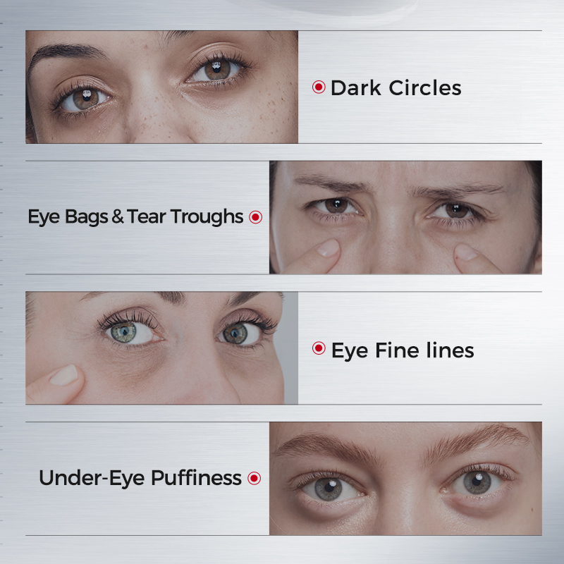 Eye Patches for Dark Circles – - đánh giá và giá Collagen Under Eye Patches