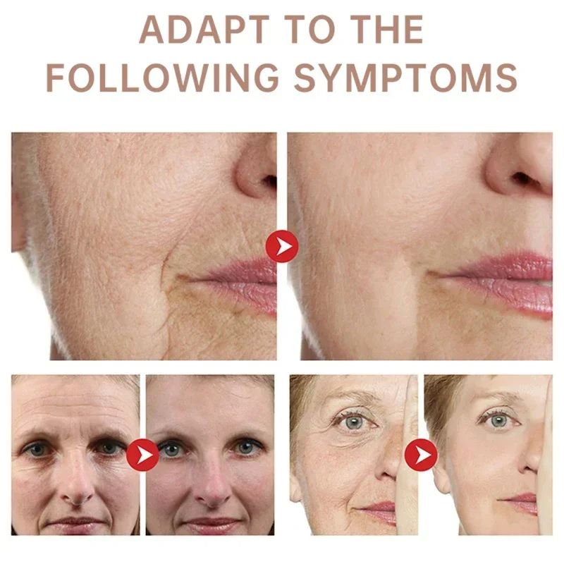 Remove Wrinkle Cream Retinol F - đánh giá và giá Retinol Anti Wrinkle Cream