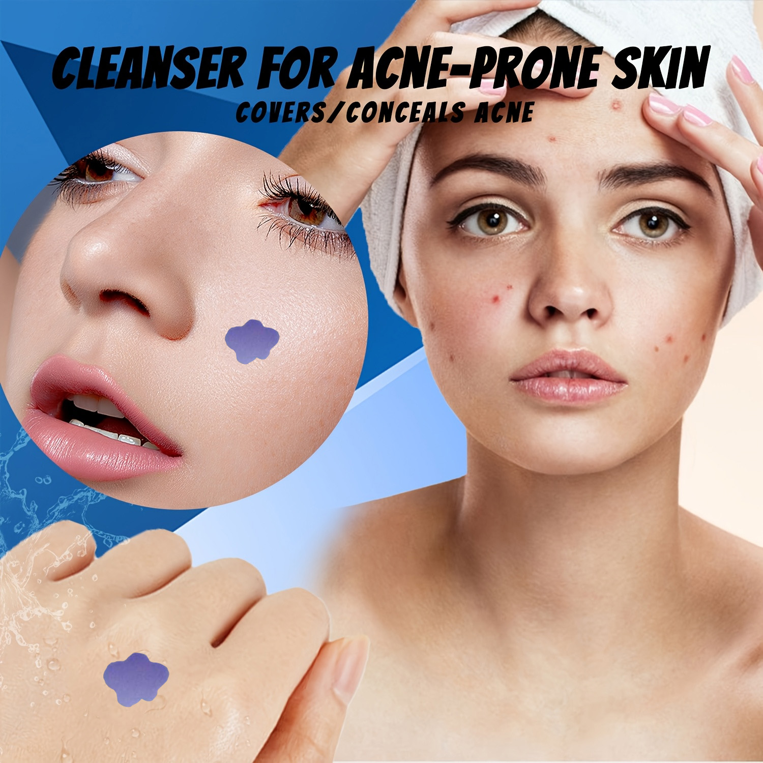 Microneedle Acne Pimple Patch  - đánh giá và giá Skincare