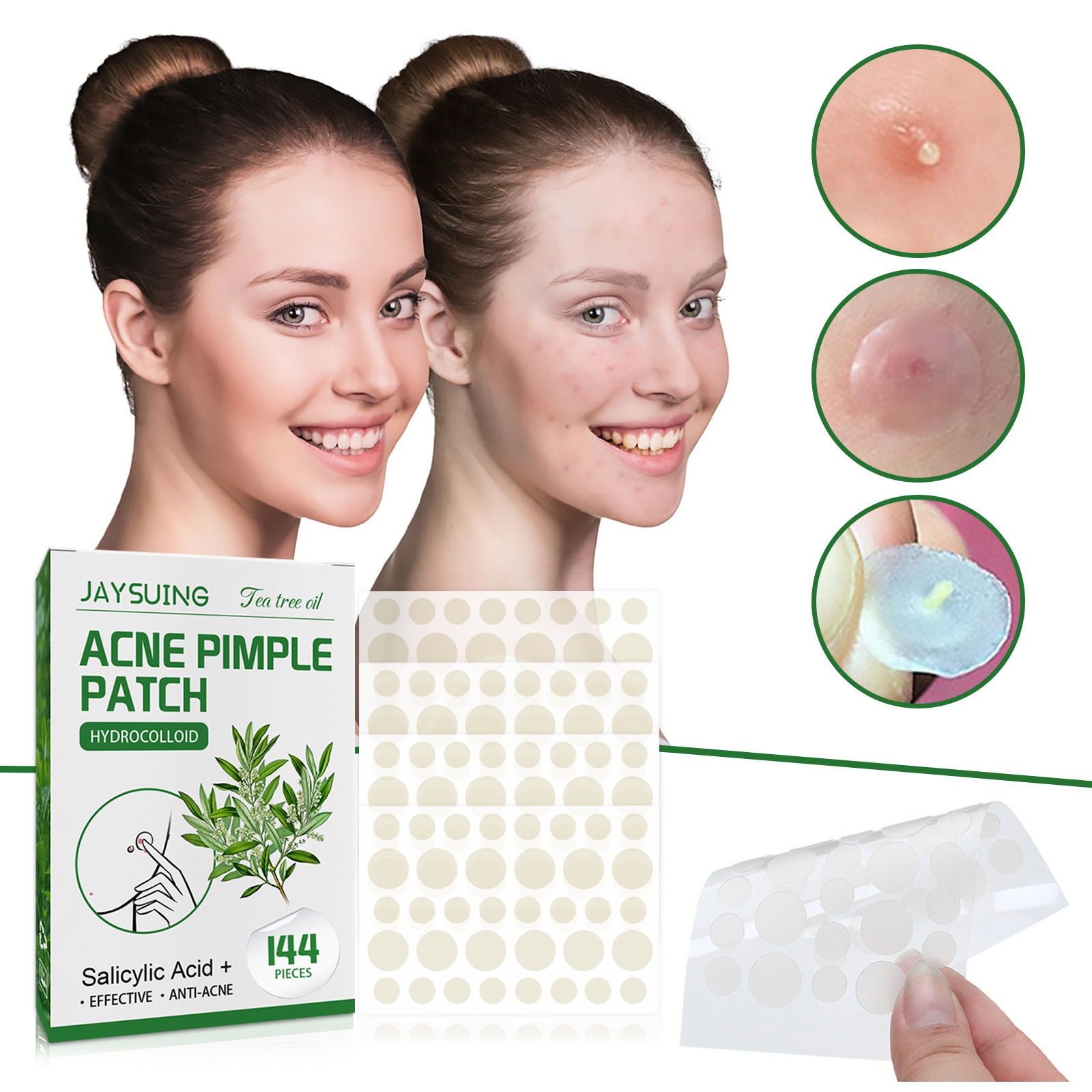 Hydrocolloid Acne Patches - Ab - đánh giá và giá Hydrocolloid Pimple Patch
